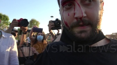 Scene from Mondragone, manifestante colpito alla testa durante una violenta carica della polizia