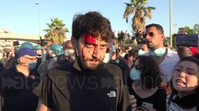 Scene from Mondragone, manifestante colpito alla testa durante una violenta carica della polizia