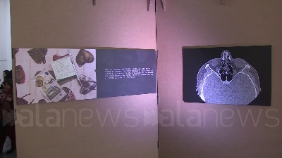 Scene from Donne, in mostra le lastre della violenza