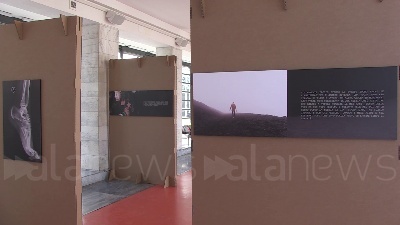 Scene from Donne, in mostra le lastre della violenza